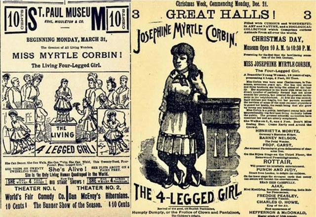 上世纪的畸形秀海报，黄色的背景，黑色的印刷文字，上面画有四条腿的女孩